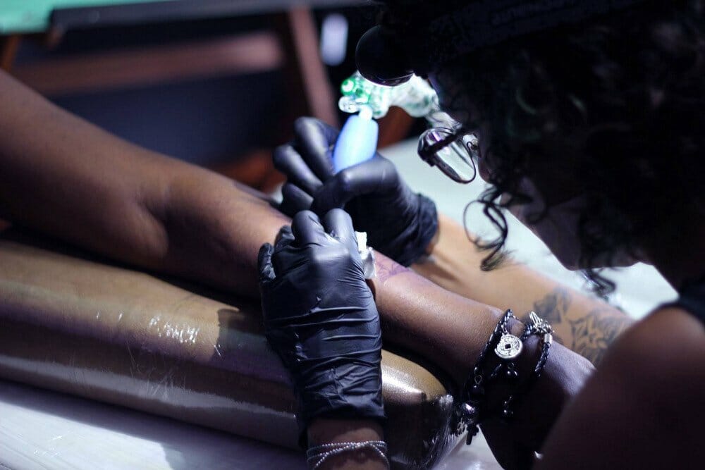 Remoção de tatuagem em pele negra ou escura