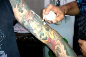 cremes de remoção de tatuagem