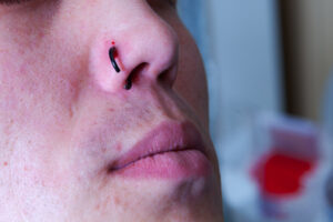 Tudo sobre cura e cicatrização do piercing no nariz