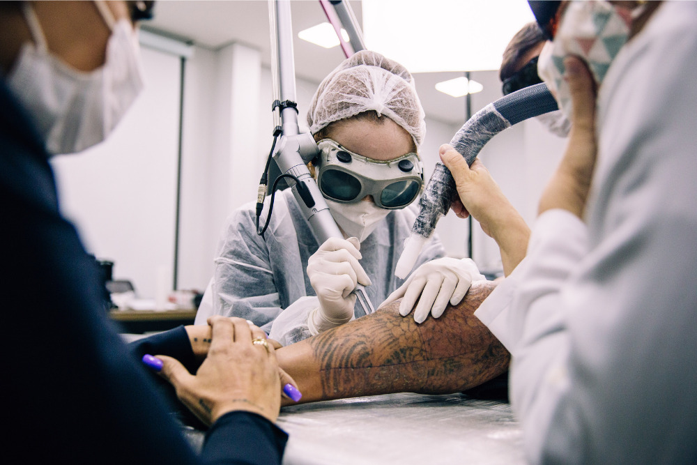 Quantas sessões para remover tatuagem a laser