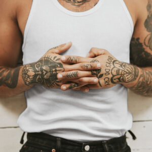 Pessoa com tatuagem - remoção de tatuagem
