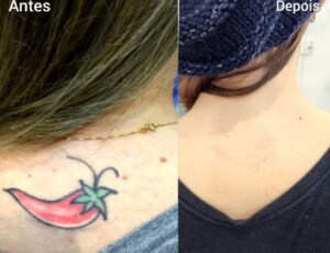 5-tatuagens-que-as-pessoas-normalmente-se-arrependem-de-fazer-03