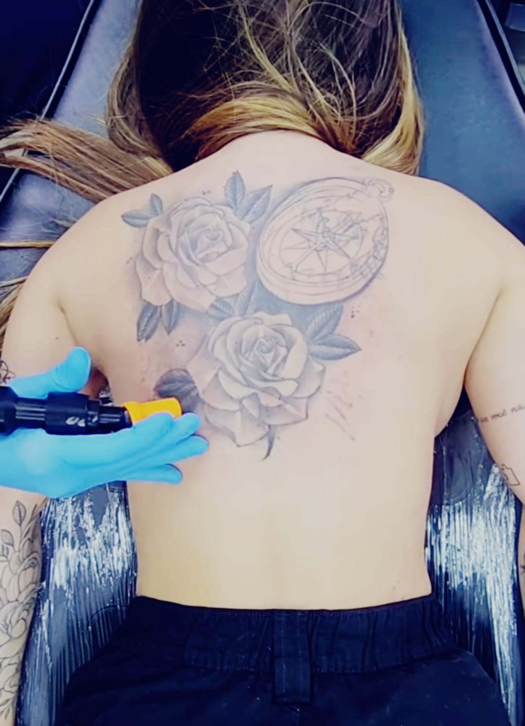Remoção de tatuagem nas costas - Hell Tattoo