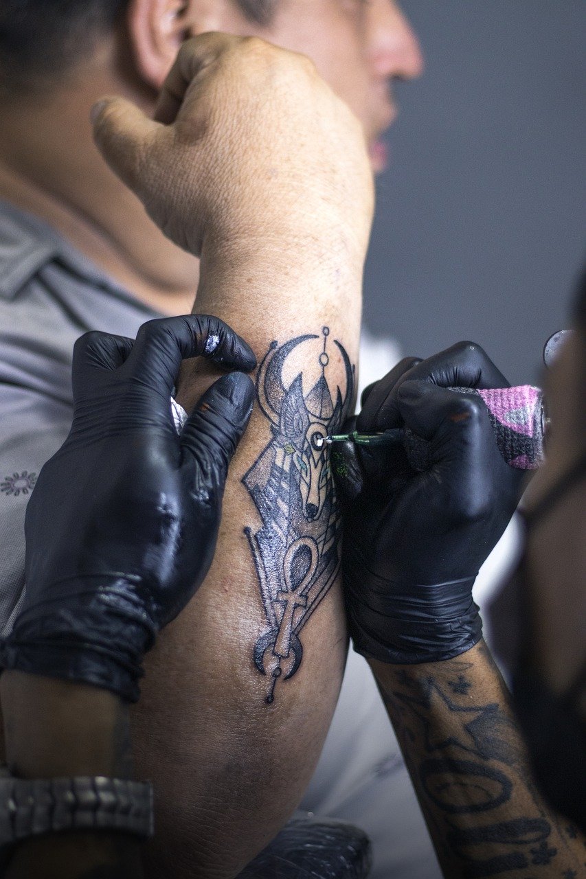 Remoção de tatuagem para cobertura