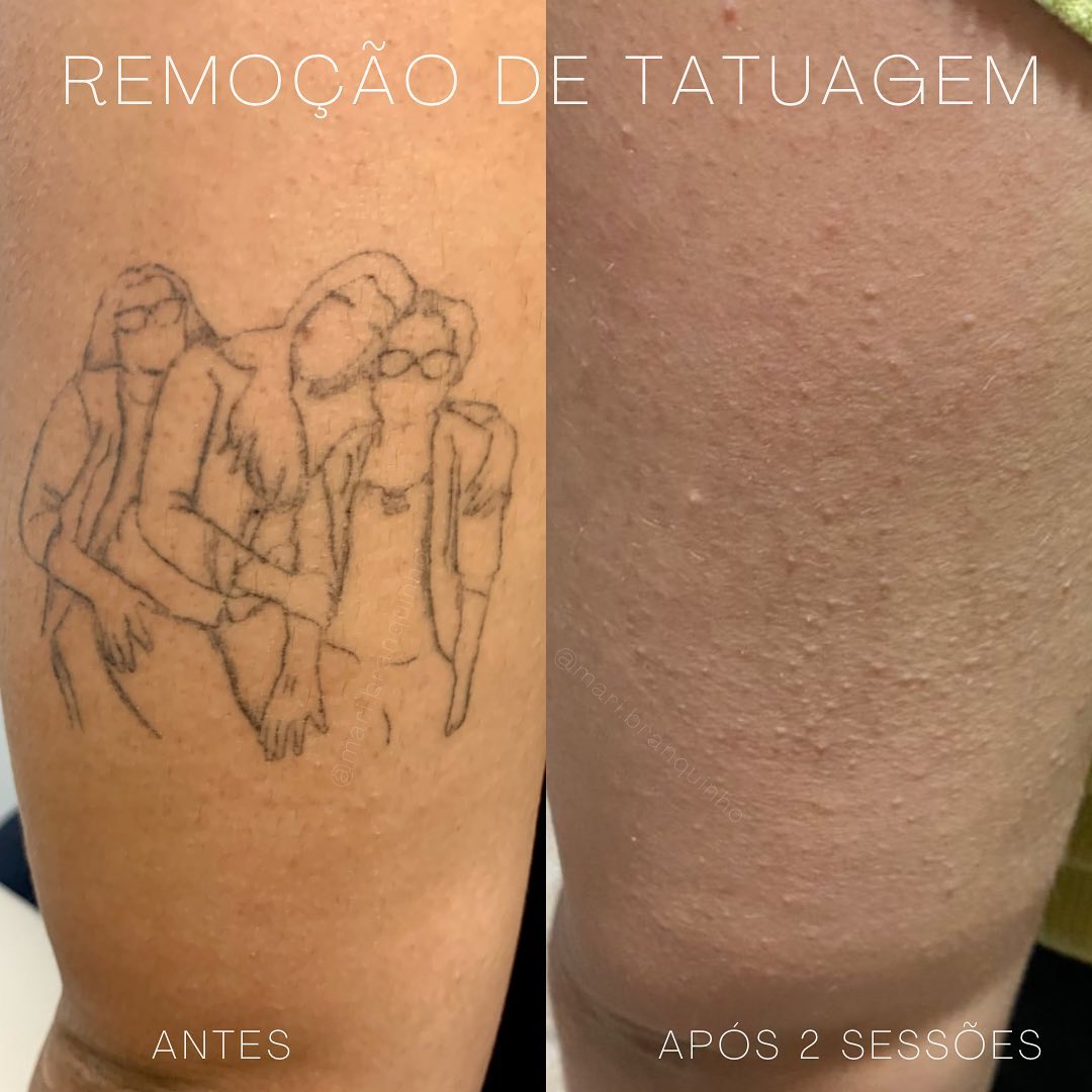 helltattoogoiania_1731982115598