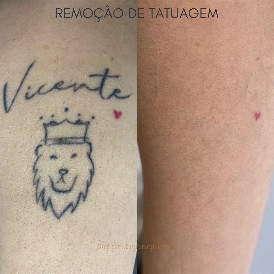 helltattoogoiania_1731982271557
