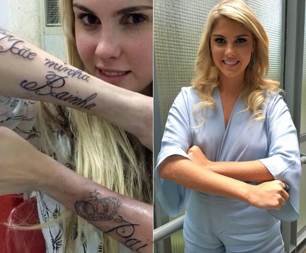 antes-e-depois barbara evans tatuagem