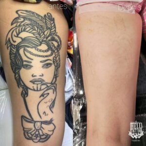 remoção de tatuagem hell tattoo