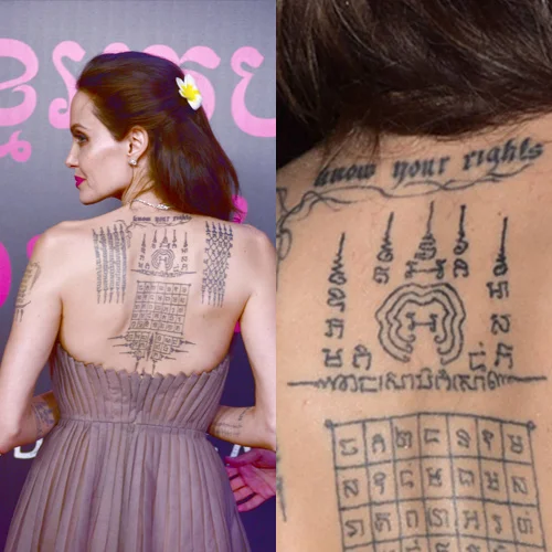 Celebridades Remoção de Tatuagem
