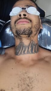 apagar tatuagem com nome ex