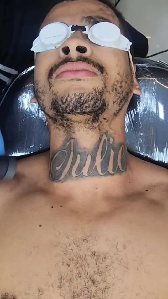 apagar tatuagem com nome ex