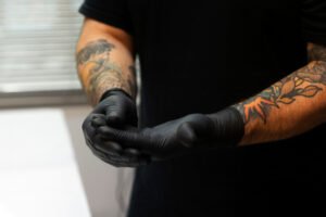 mercado remoção de tatuagem 2