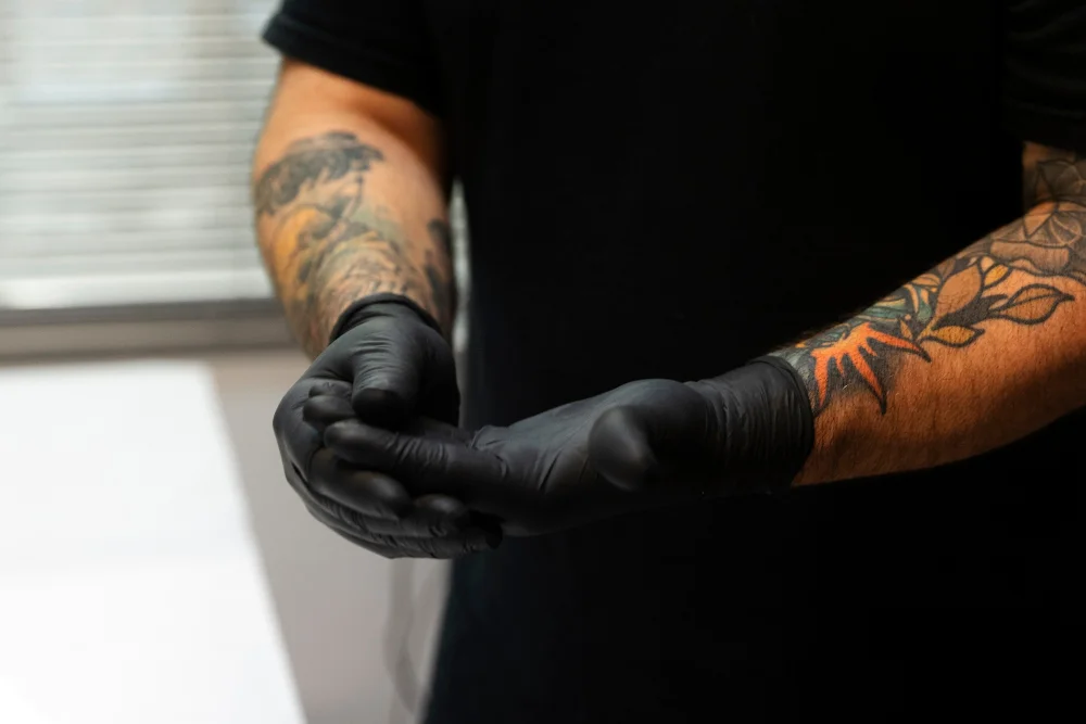 mercado remoção de tatuagem 2