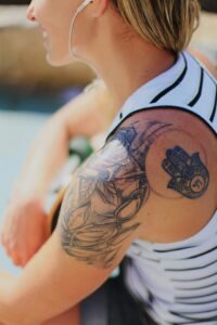 Remoção de Tatuagem a Laser