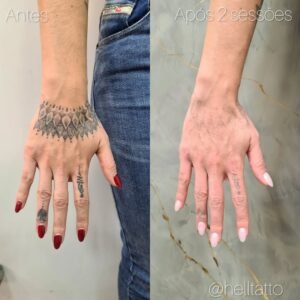 tatuagens-que-as-pessoas-mais-se-arrependem