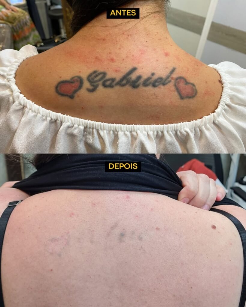 tatuagens removidas hell tattoo