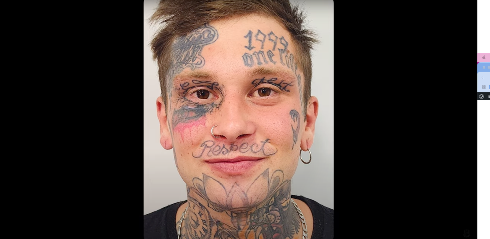 Remoção de tatuagem no rosto