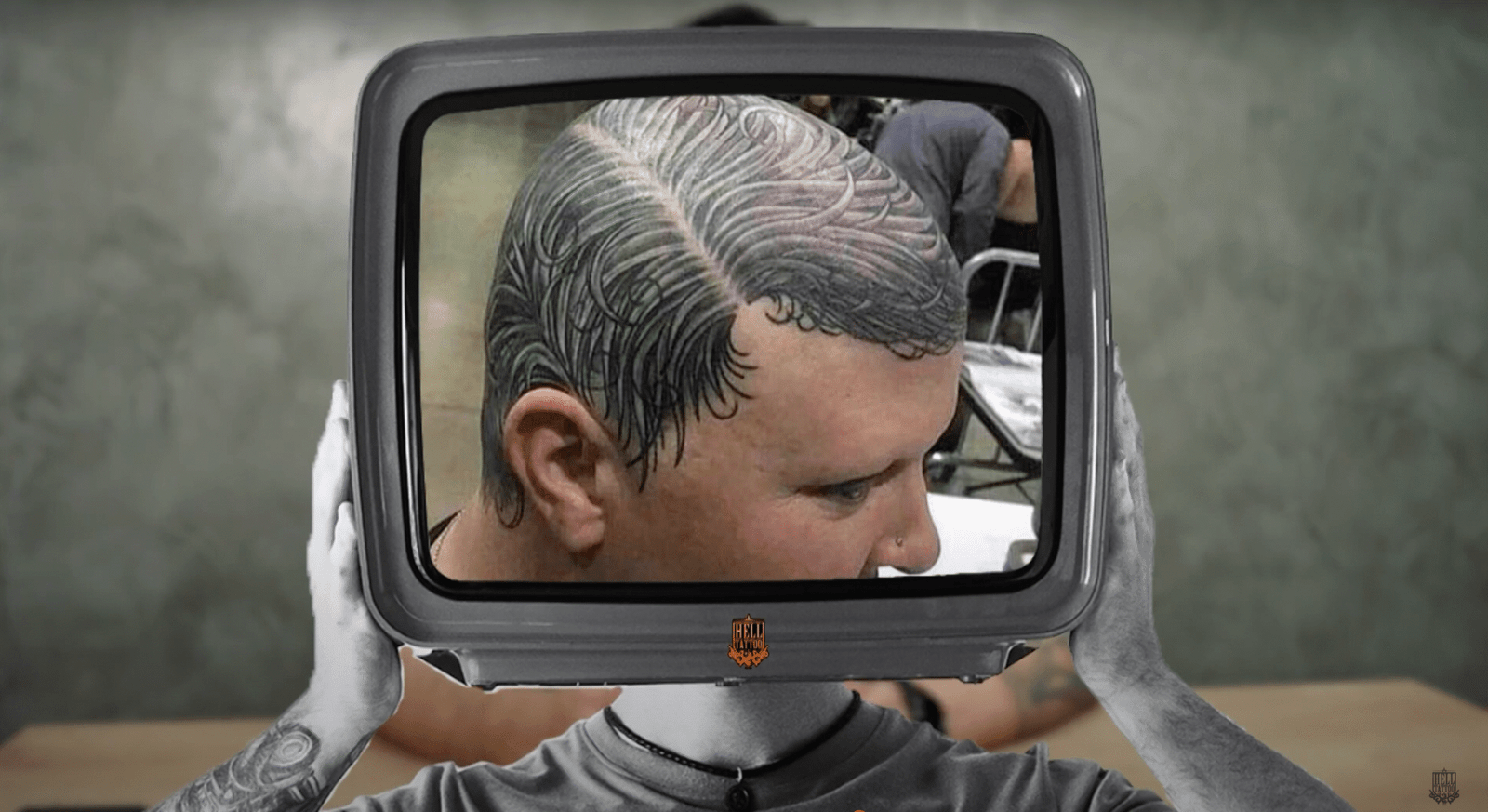 Remoção de Micropigmentação Capilar