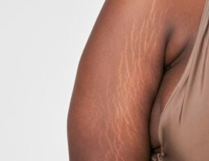 camuflagem de estrias - Foto: Freepik