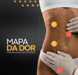 onde-mais-doi-remover-tatuagem