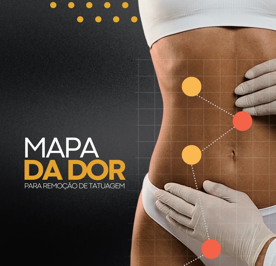 onde-mais-doi-remover-tatuagem