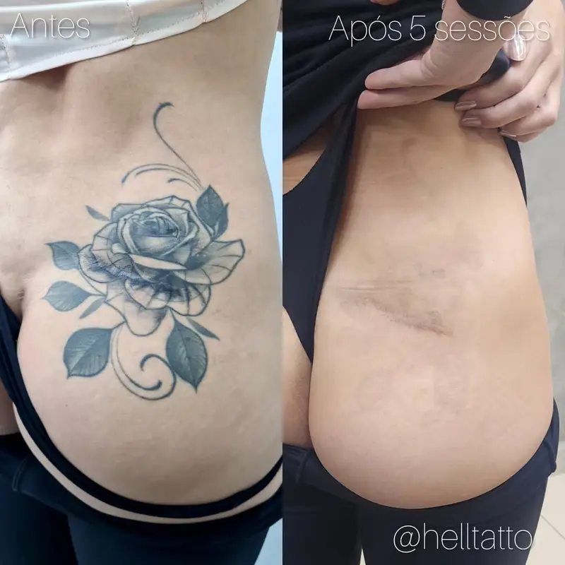tatuagem para esconder cicatriz