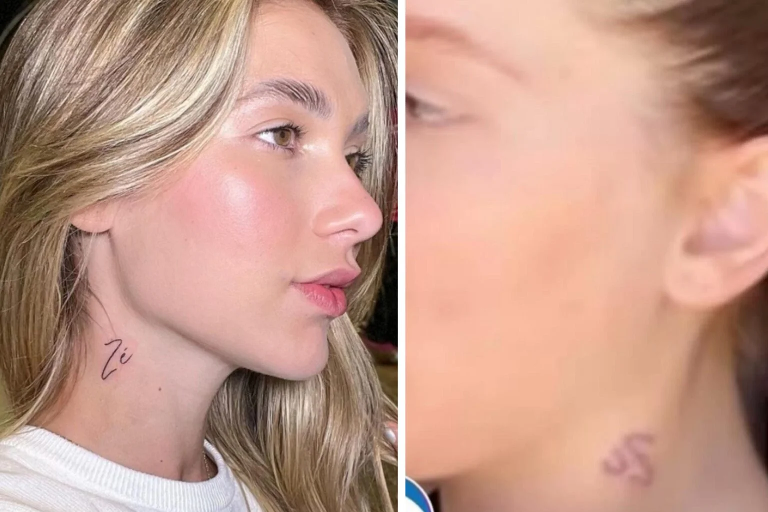 Virgínia Fonseca Remoção de Tatuagem