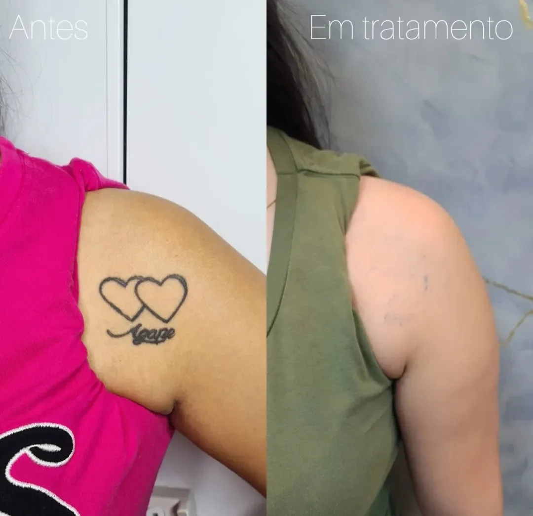 a-hell-tattoo-e-uma-boa-clinica