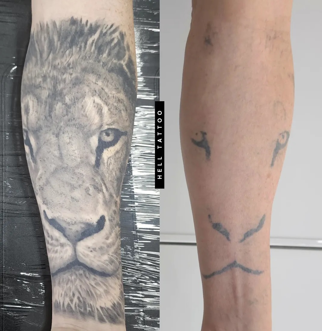 por-que-tatuagens-mais-antigas-costumam-sair-mais-rapido