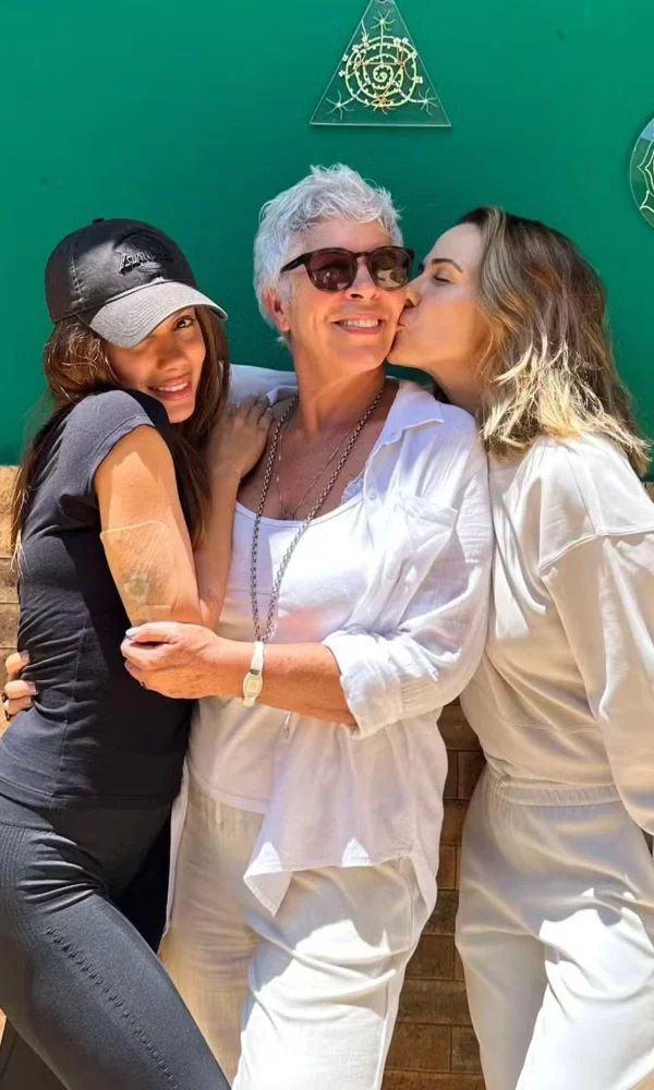 Remoção de Tatuagem Anitta