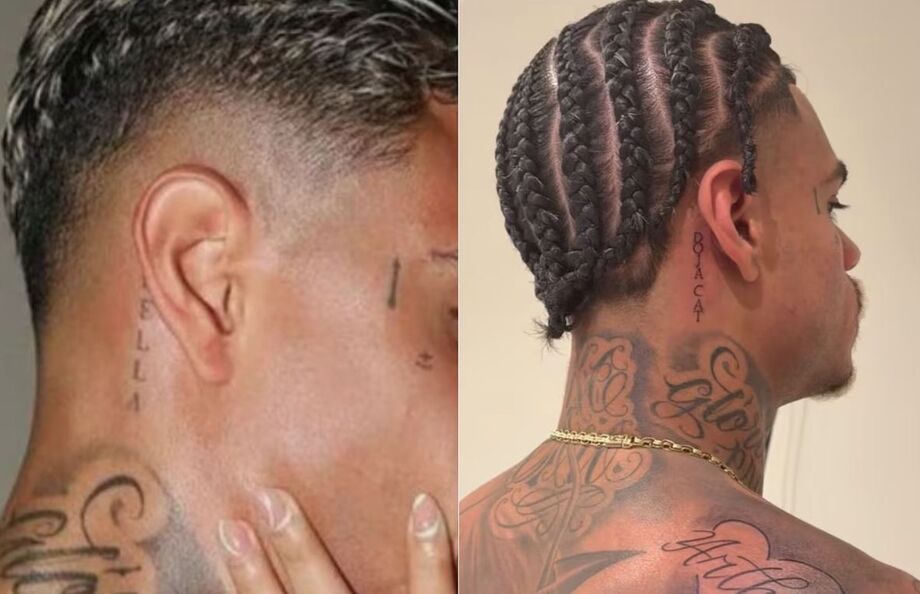 MC Cabelinho Remove tatuagem