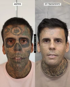homem-mais-tatudo-do-brasil-realiza-6a-sessao-02