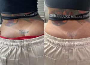 jenny-miranda-inicia-remocao-de-tatuagem - Foto: Reprodução do Instagram