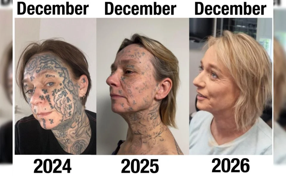 homem-tatua-a-forca-o-proprio-nome-no-corpo-da-namorada - Foto- Reproducao Fundação Sem Mais Tatuagens