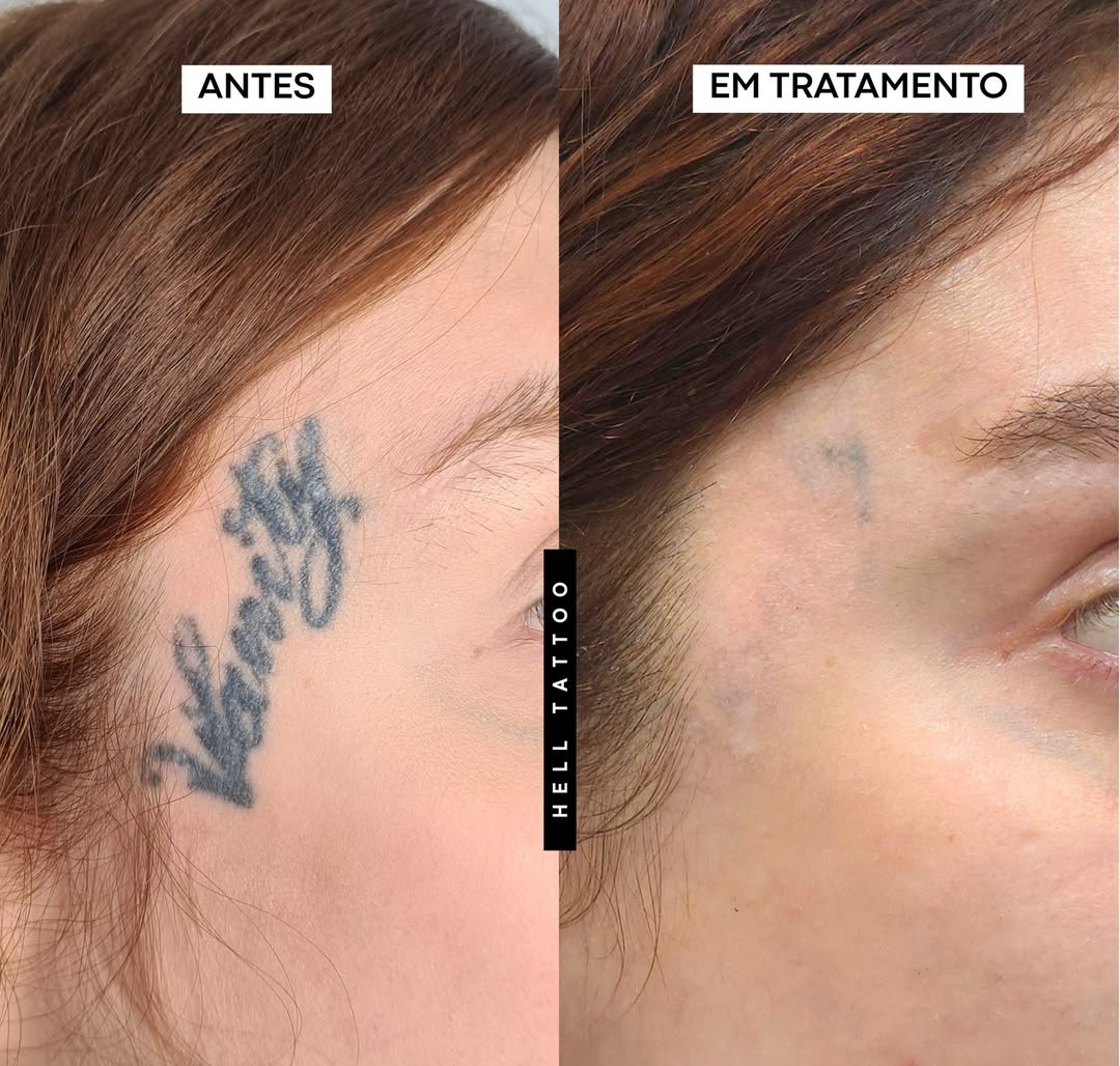 tatuagem-falhada-01