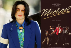 vitiligo michael jackson - Foto - Getty Images e Divulgação