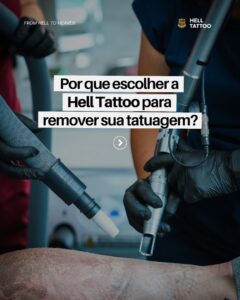 5-diferenciais-da-hell-tattoo-por-que-escolher-uma-clinica-especializada
