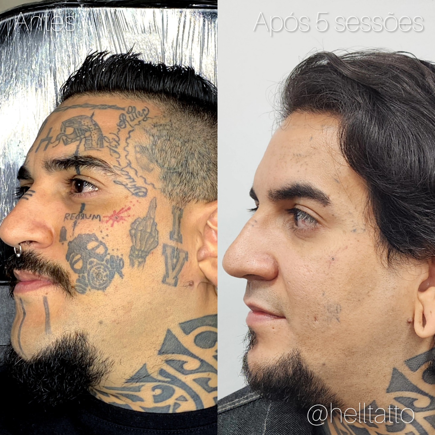 campanha cara limpa