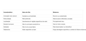 nevo de ota melasma 02