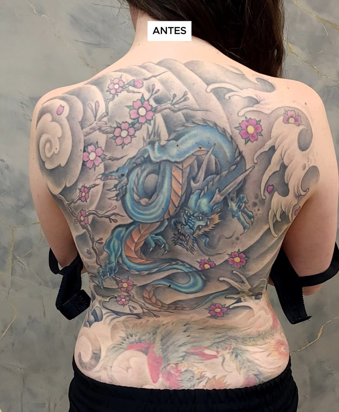 o-tamanho-da-tatuagem-interfere-no-tempo-de-remocao-entenda-01