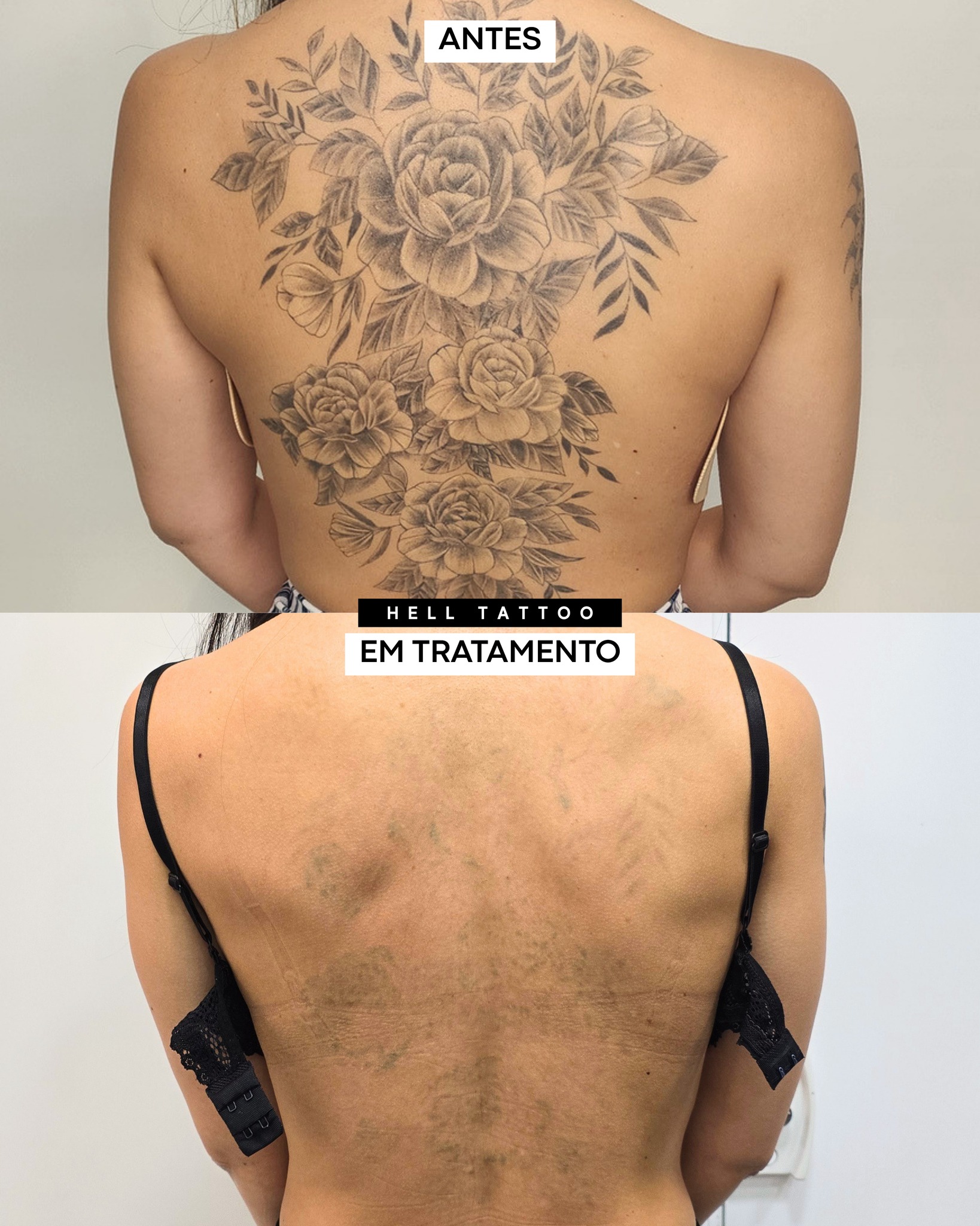 por-que-algumas-tatuagens-parecem-sumir-e-depois-voltam