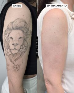 tatuagem-com-sombra-demora-mais-para-sair-02
