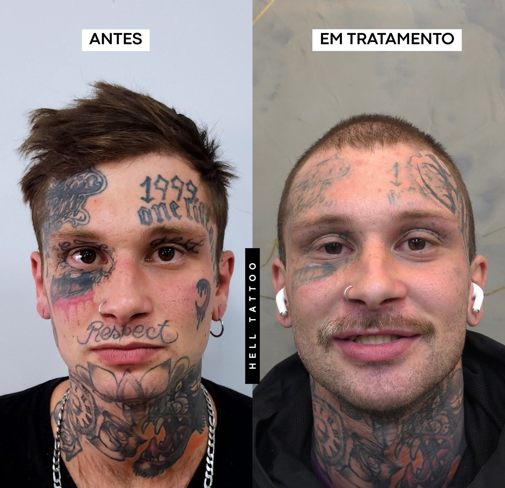 tatuagem feita por amador
