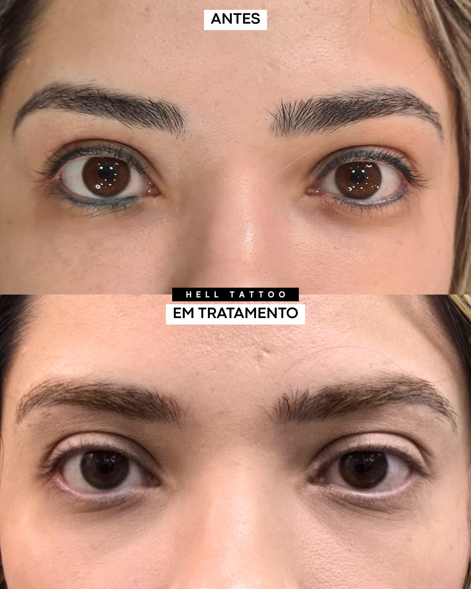 minha-micropigmentacao-ficou-cinza-02