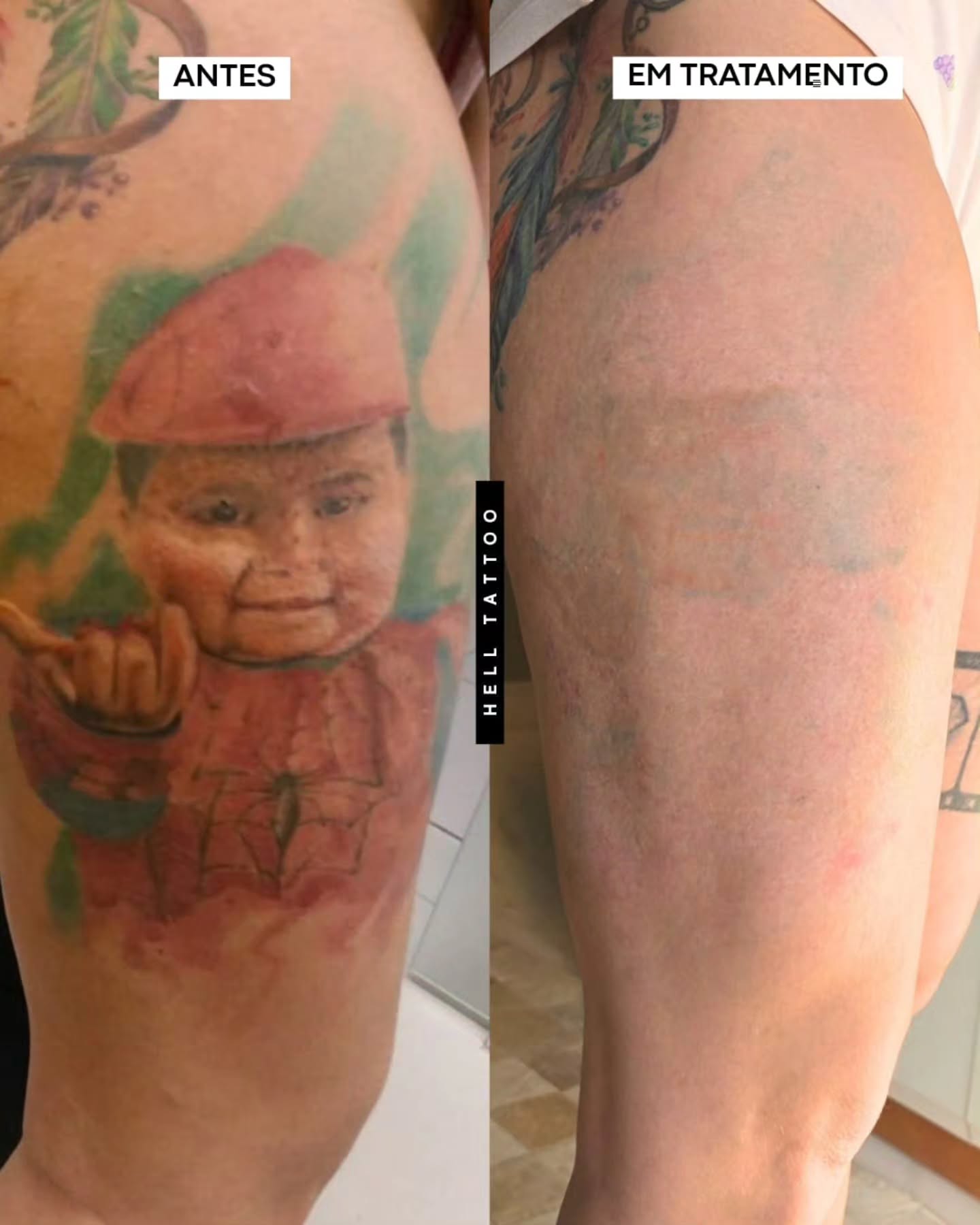 tatuagem-vermelha-sai-com-laser
