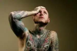 medo de remover uma tatuagem