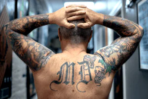 Deseja apagar uma tatuagem