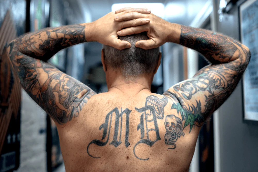 Deseja apagar uma tatuagem