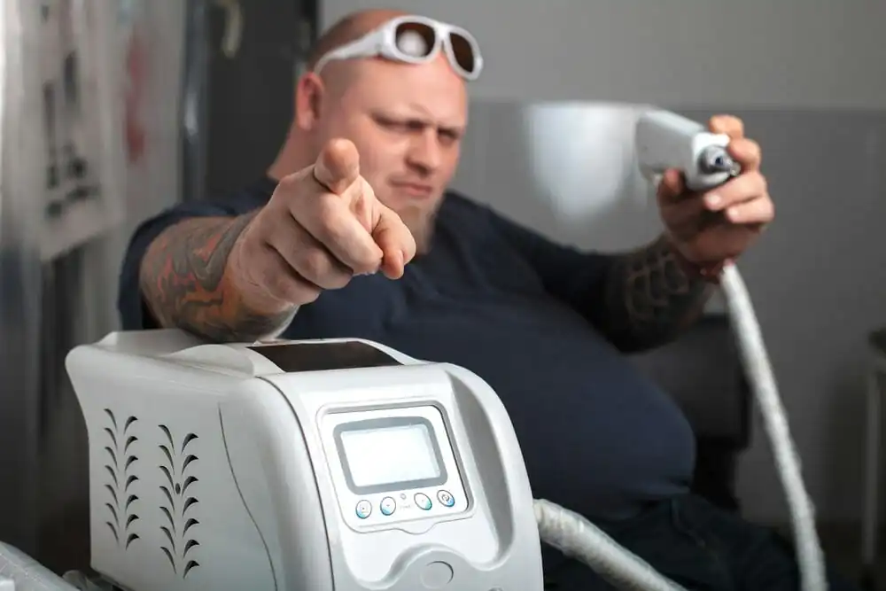 formas de remover tatuagem