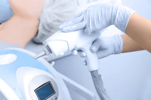 melhores lasers para remoção de tatuagem